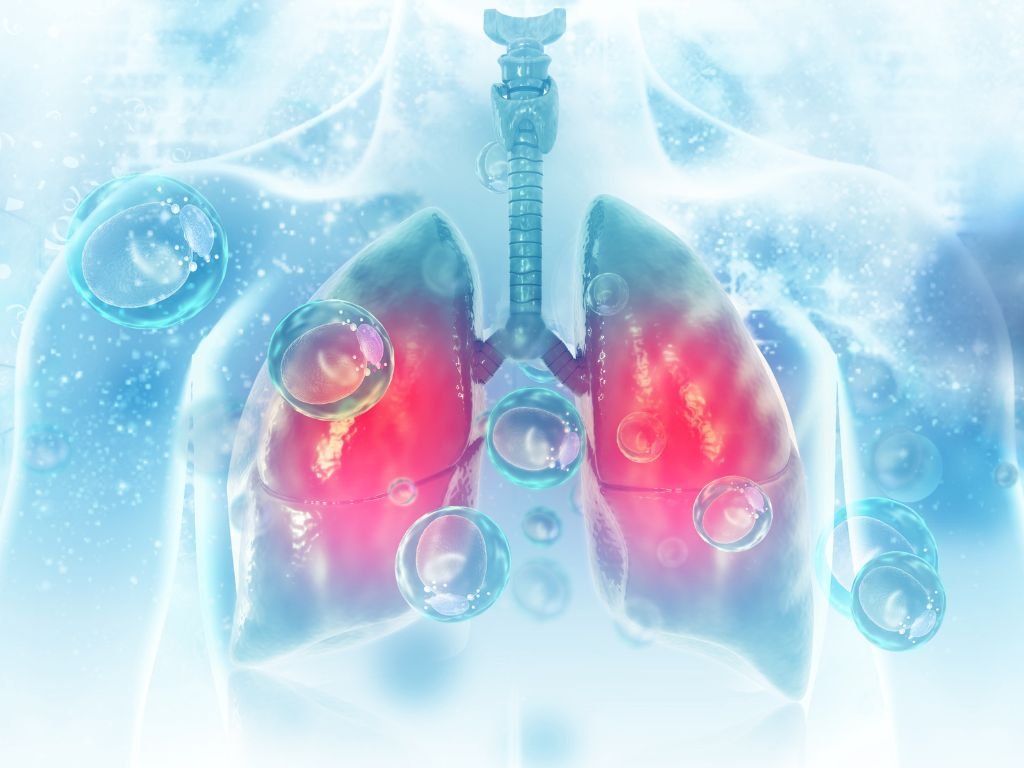 Pleural Tapping